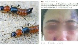 Kiến ba khoang tấn công ký túc xá sinh viên